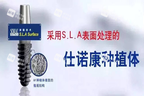 仕诺康种植牙宣传.jpg 仕诺康种植牙宣传.jpg