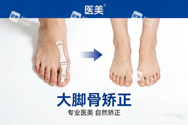大脚骨矫正前后对比图.jpg 大脚骨矫正前后对比图.jpg
