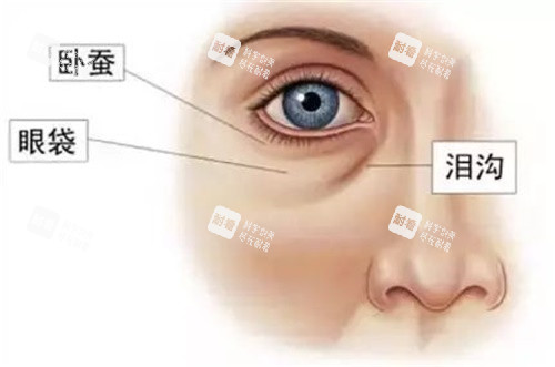 眼部结构示意图.jpg 眼部结构示意图.jpg