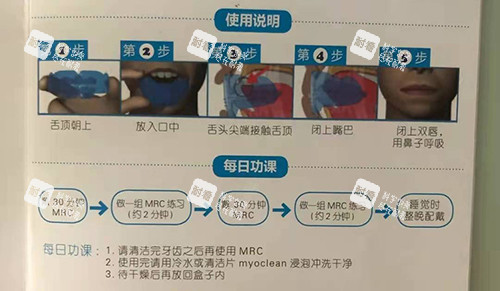 牙齿矫正MRC早期肌功能矫正说明.jpg 牙齿矫正MRC早期肌功能矫正说明.jpg