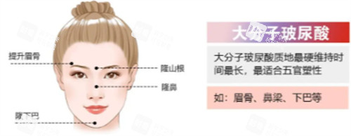 大分子玻尿酸简介.jpg 大分子玻尿酸简介.jpg