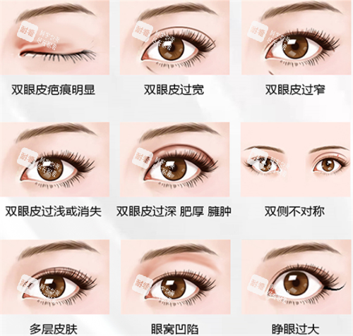 北京客莱美舍整形手术过程.png 北京客莱美舍整形手术过程.png