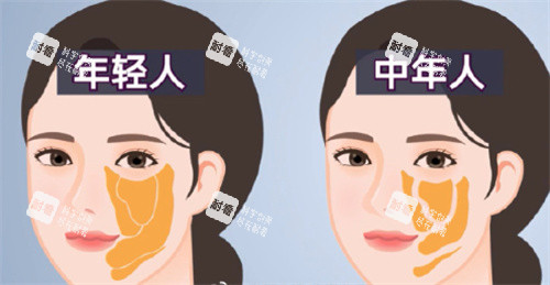 面部脂肪室对比.jpg 面部脂肪室对比.jpg