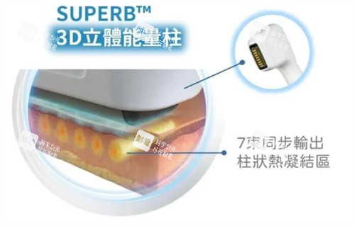 索夫波sofwave仪器能量柱.jpg 索夫波sofwave仪器能量柱.jpg