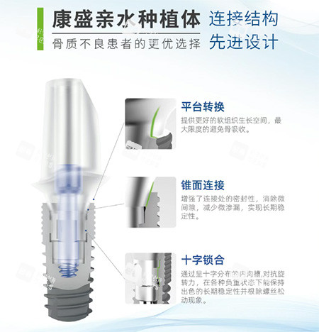 康盛亲水种植牙.jpg