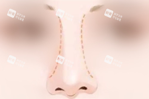 鼻部形态曲线展示图.jpg 鼻部形态曲线展示图.jpg