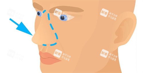 鼻部画线展示图.jpg 鼻部画线展示图.jpg