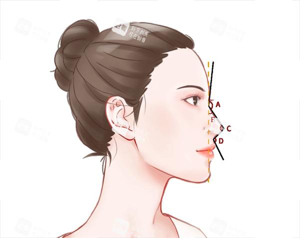 鼻尖塑形.png 鼻尖塑形.png