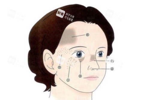 脸上有胎记卡通展示图.jpg 脸上有胎记卡通展示图.jpg