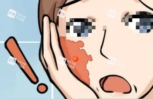 脸上胎记生长图.jpg 脸上胎记生长图.jpg
