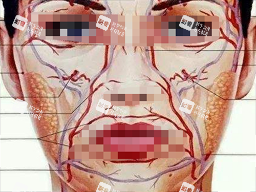 玻尿酸栓塞静脉动脉展示图.png