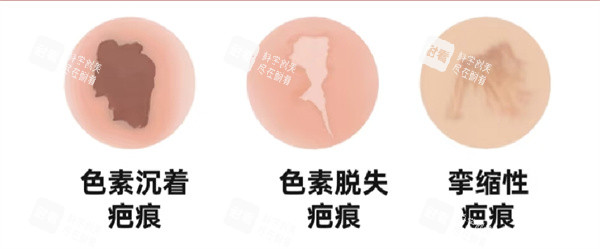 疤痕图片.jpg 疤痕图片.jpg