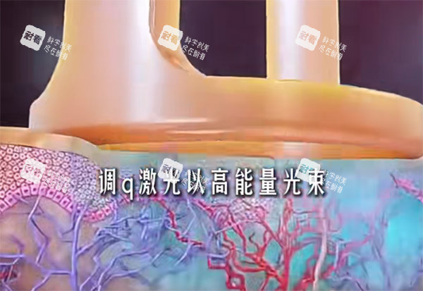 调Q激光原理图片.jpg 调Q激光原理图片.jpg