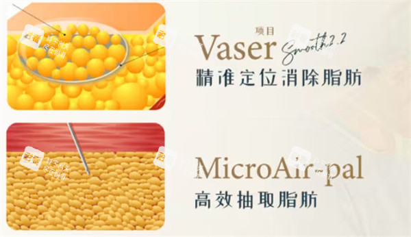 吸脂多少钱.jpg 吸脂多少钱.jpg