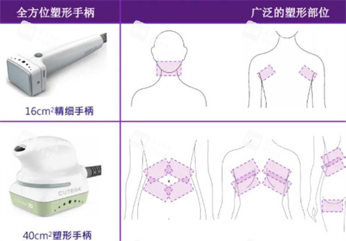 美国既塑3D溶脂使用部位.jpg 美国既塑3D溶脂使用部位.jpg