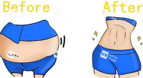 溶脂前后对比.jpg 溶脂前后对比.jpg