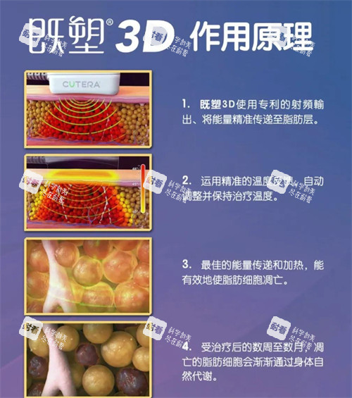 美国既塑3D溶脂作用原理.jpg 美国既塑3D溶脂作用原理.jpg