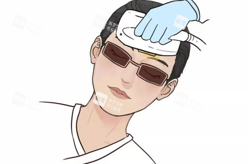 激光美白漫画示意图.jpg