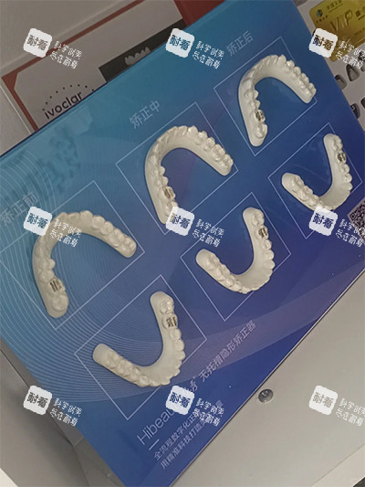 隐秀隐形牙齿矫正.jpg 隐秀隐形牙齿矫正.jpg