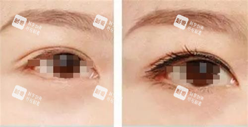 纹眼线前后的区别.png