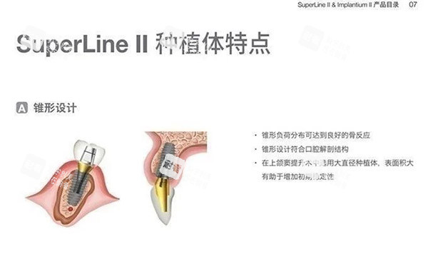 登腾二代种植体特色图片.jpg
