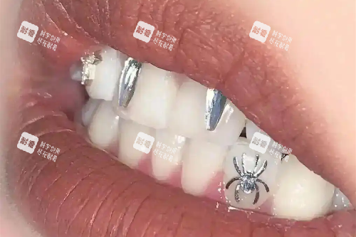 牙齿纹身图片实拍.webp.png 牙齿纹身图片实拍.webp.png