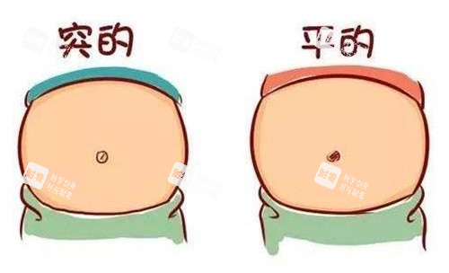 肚脐整形前后对比.jpg