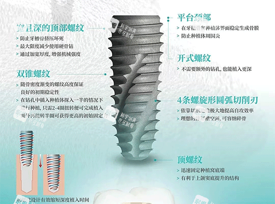 韩国伊诺种植牙植体照片.png 韩国伊诺种植牙植体照片.png