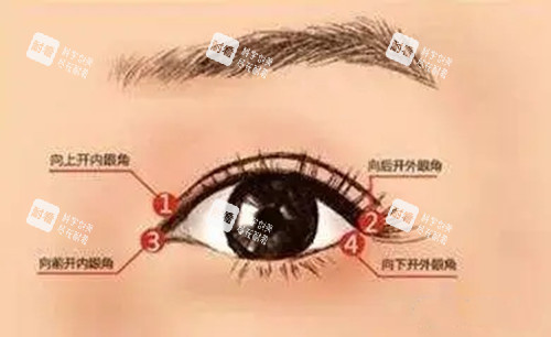 开内外眼角.webp.jpg 开内外眼角.webp.jpg