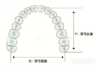 牙弓尺寸照片.gif 牙弓尺寸照片.gif