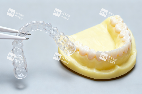 隐形保持器卡通展示图.png 隐形保持器卡通展示图.png