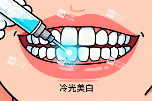 牙齿冷光美白卡通图.png