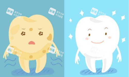 牙齿美白前后对比图.png