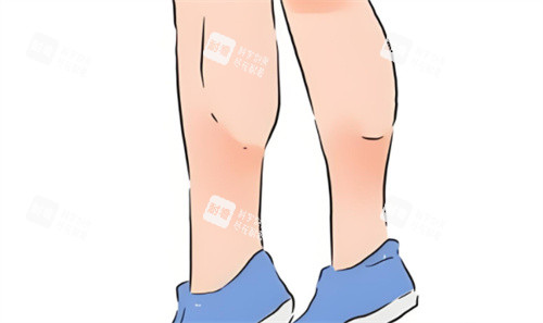肌肉型小腿.jpg 肌肉型小腿.jpg