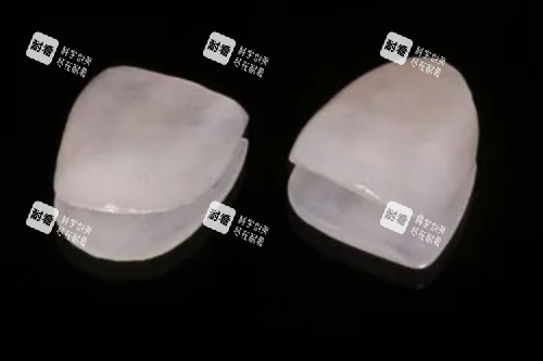牙贴面材料卡通图.jpg