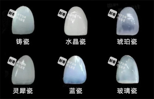 牙贴面材料.jpg