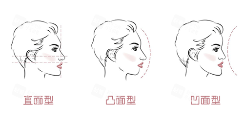 牙齿矫正面型问题.png 牙齿矫正面型问题.png
