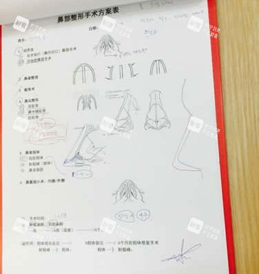 北京柏丽医疗美容医院李劲良做鼻子设计.jpg