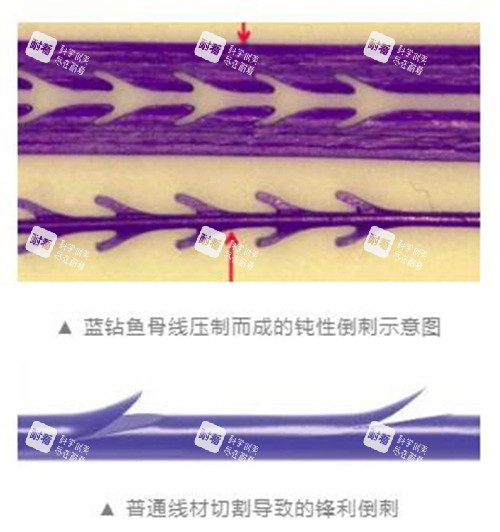蓝钻鱼骨线.jpg