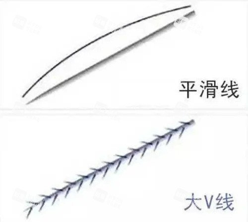 大V线图片.jpg