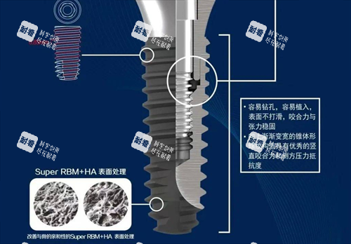 种植牙处理.png